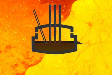 Graphite Electrode - GURATANEE